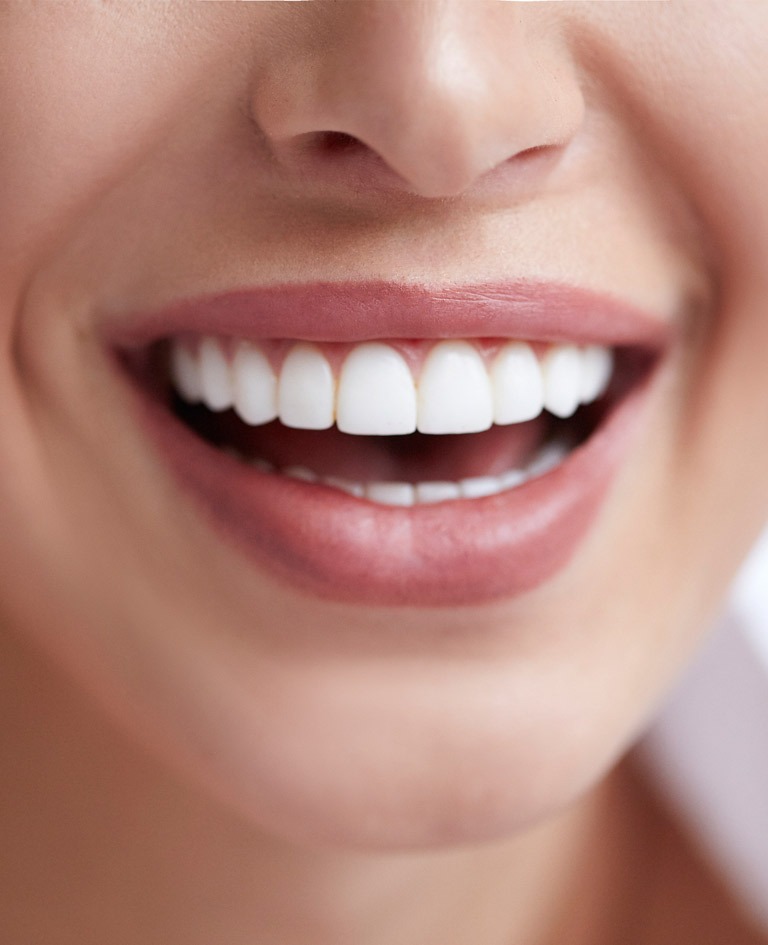 Co to są licówki zębowe i jak odmienią Twój uśmiech?