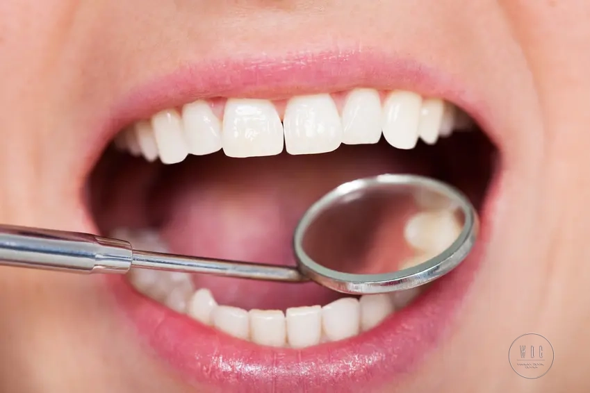 Otwarte usta podczas kontroli dentystycznej