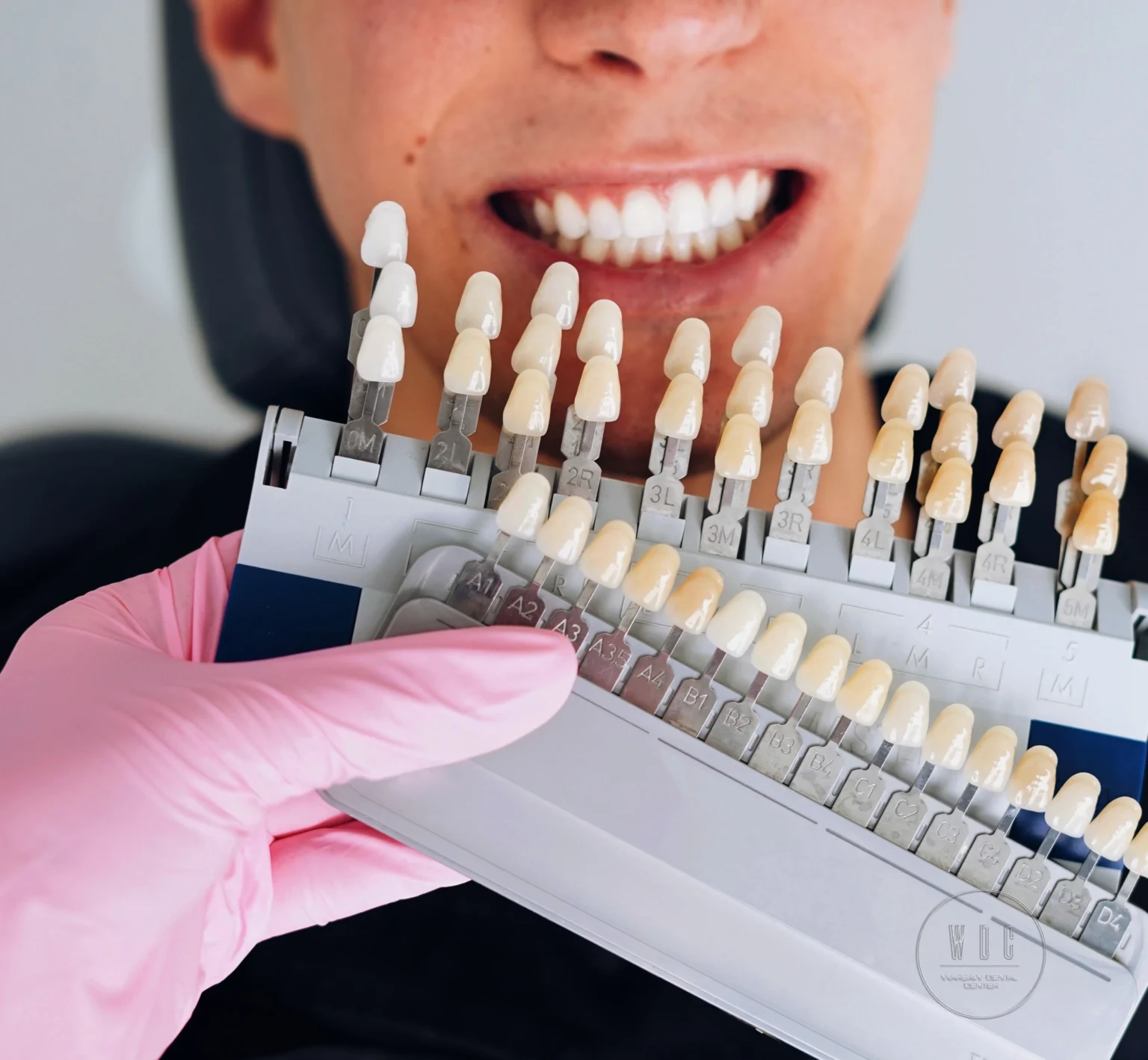 Lekarz wybiera odcień do wybielania zębów pacjenta