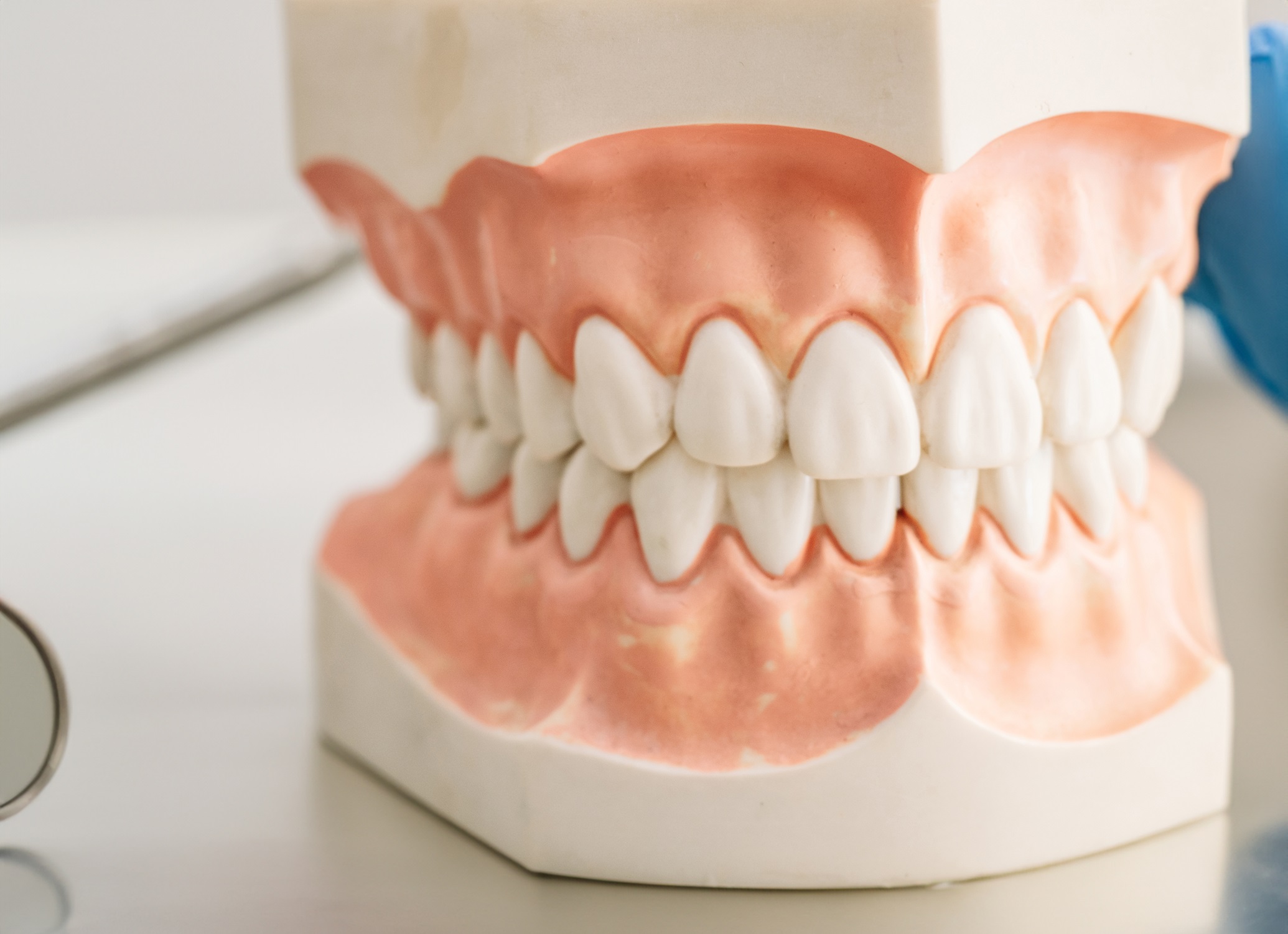 Mould of human teeth. Oral health concept. Mould of human teeth. Close up dental gypsum model. Plaster cast human jaws prothetic laboratory. Oral health concept