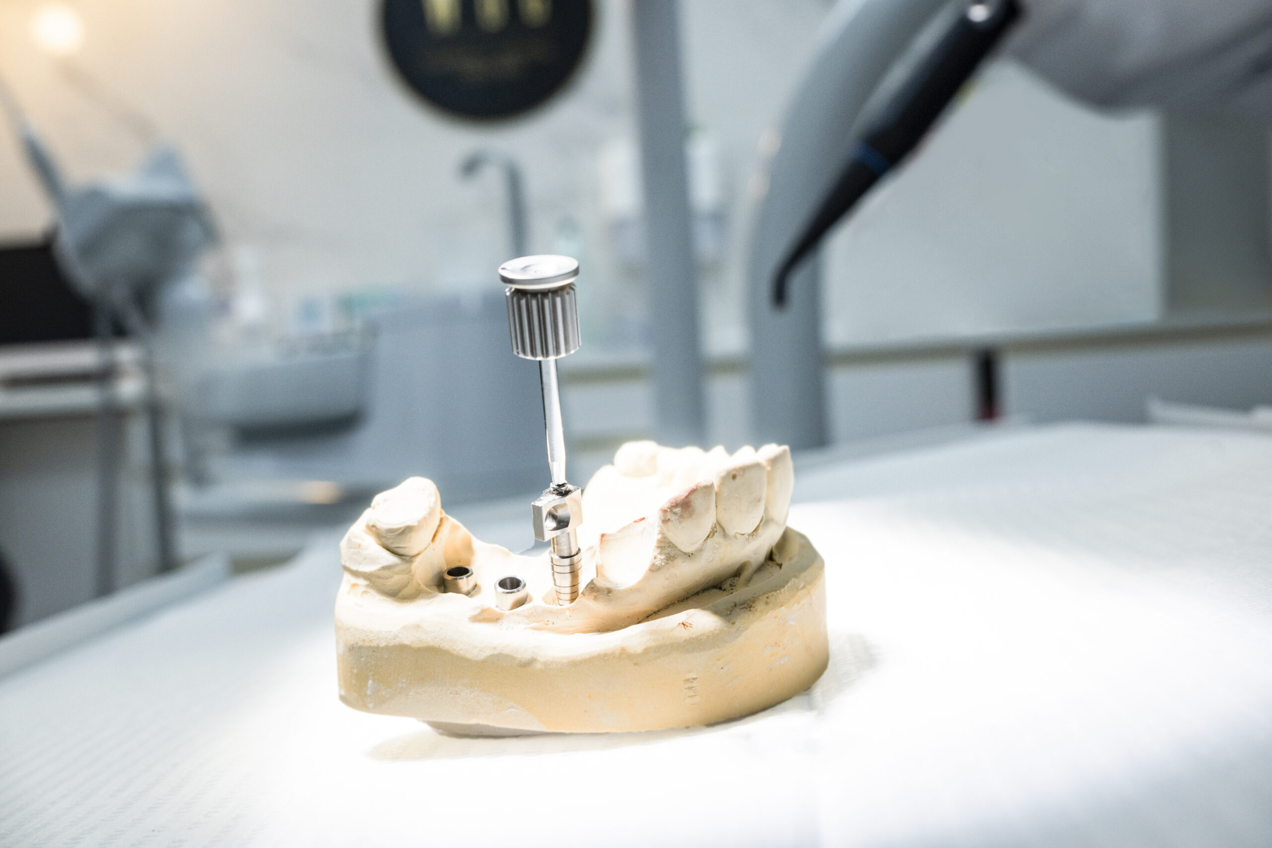 wszczepieniu implantu dentystycznego