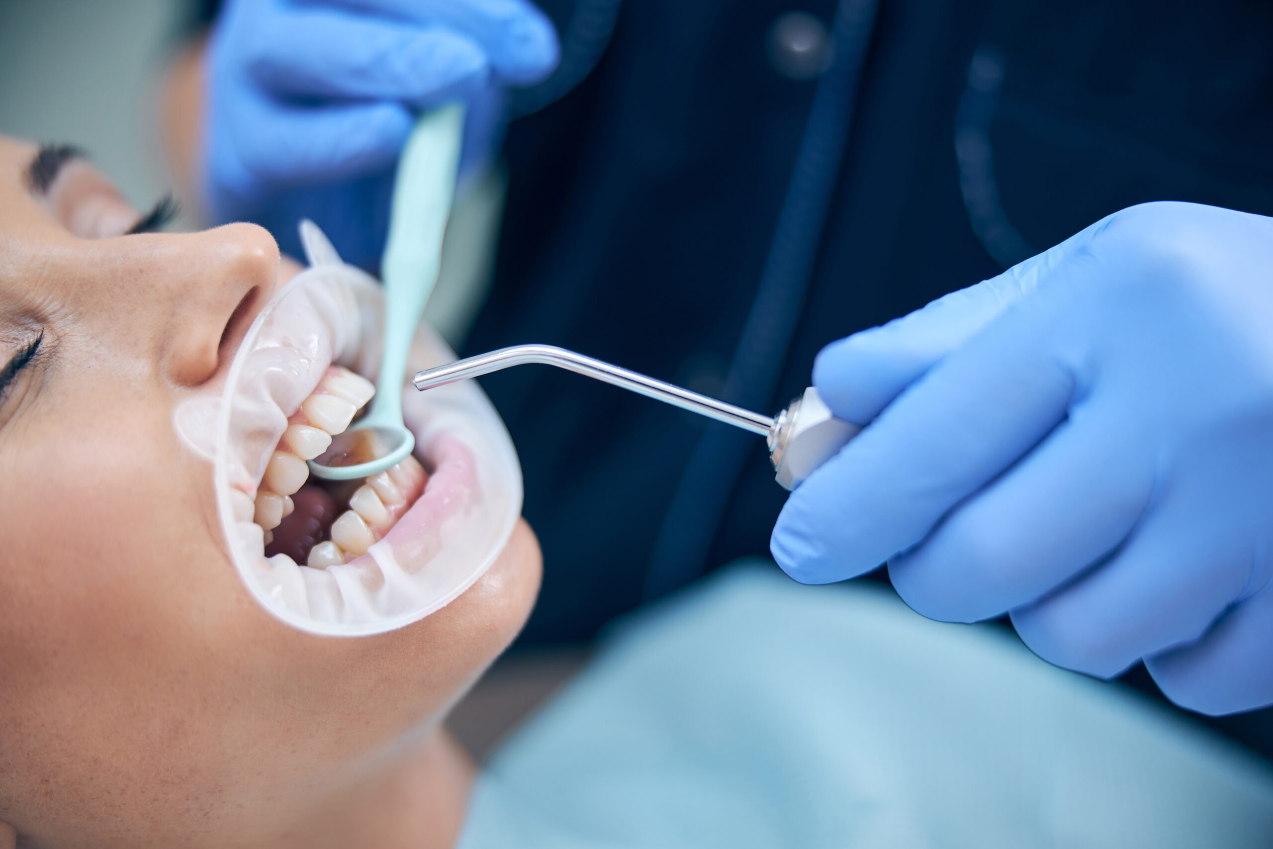 Young woman taking care of teeth at dentist