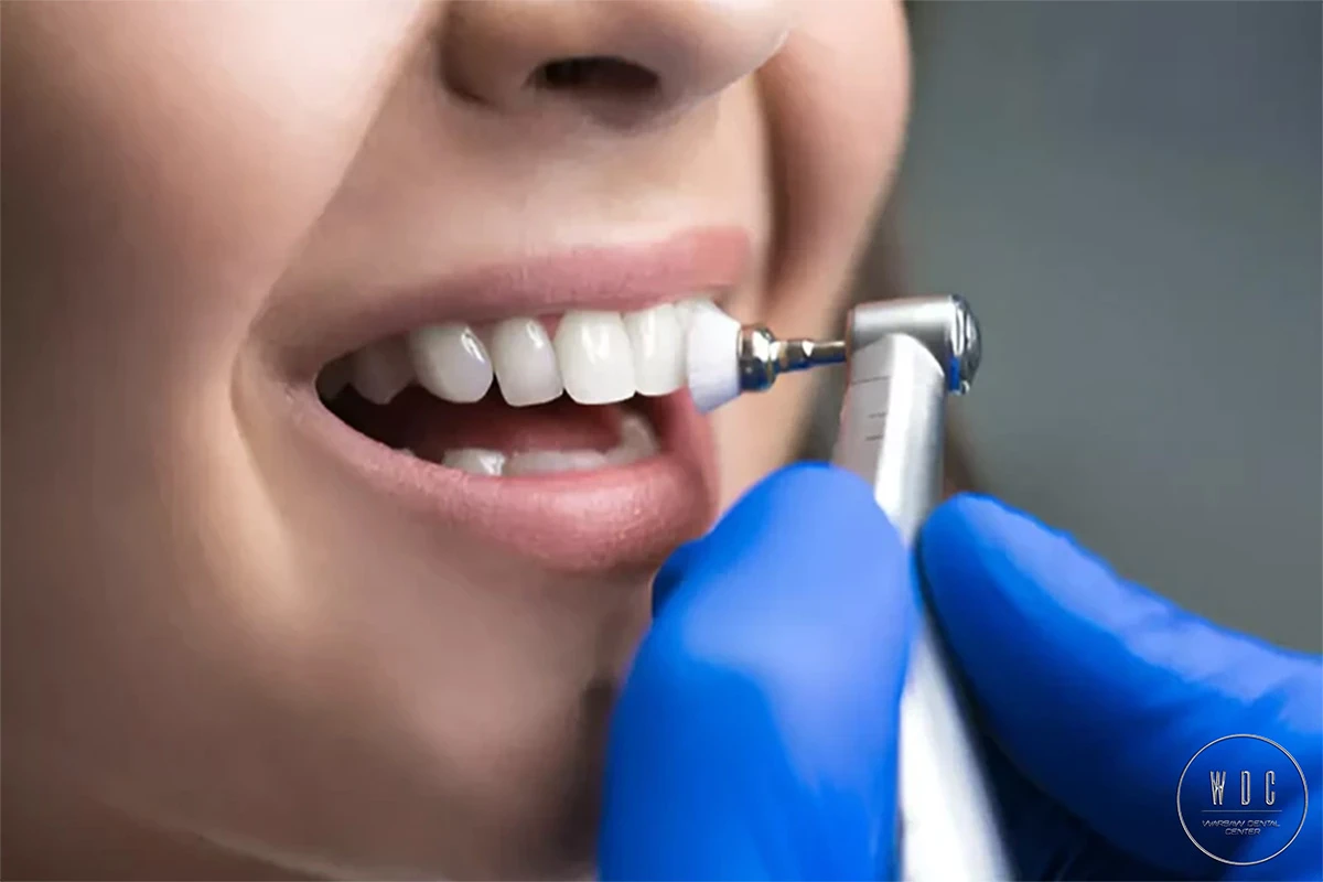 A woman is smiling during oral hygiene performed by a dental hygienist.