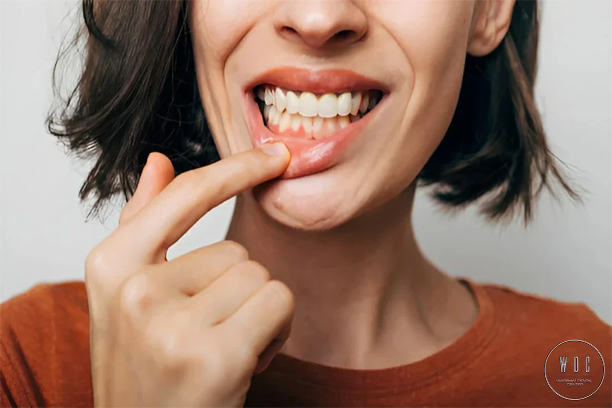 Woman is showing healthy gums.