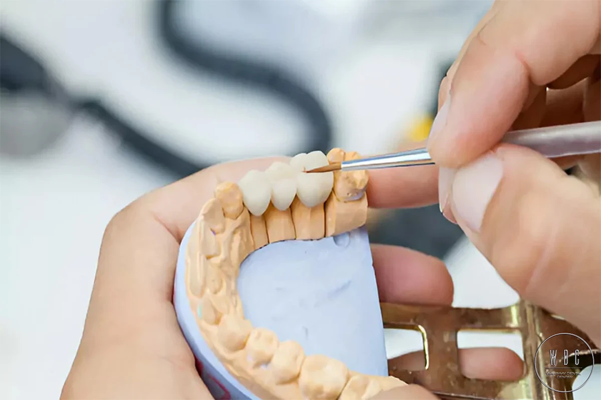 A dental technician is working on porcelain bridges.