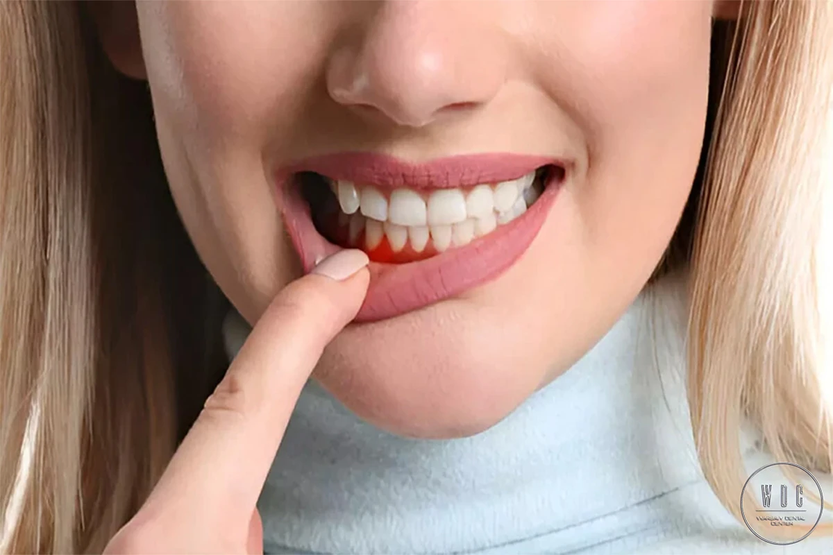 Woman is pointing to her healthy gums.