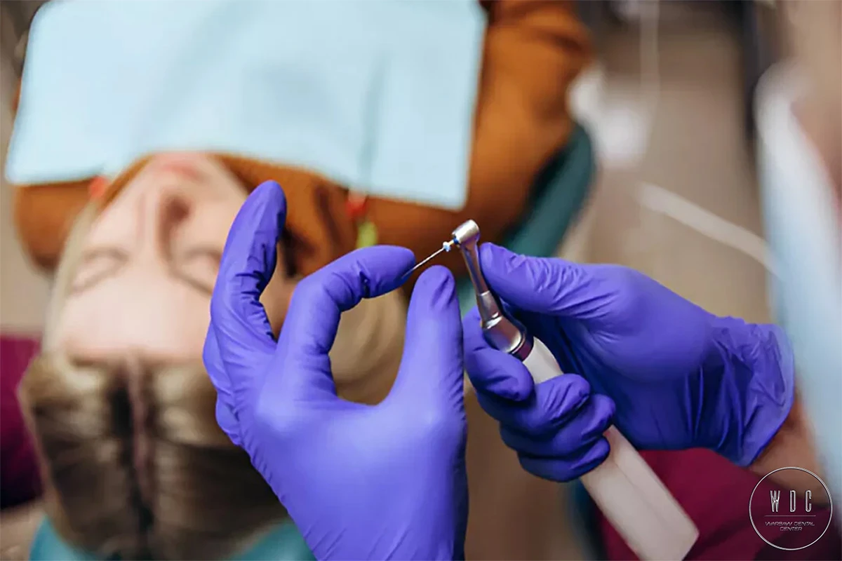 Zbliżenie na ręce trzymające wiertło dentystyczne, przygotowujące się do leczenia kanałowego.