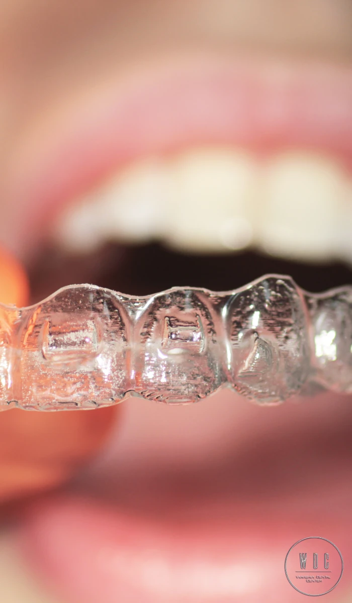 Prosto ustawione zęby pacjenta po leczeniu Invisalign w Warsaw Dental Center