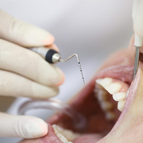 What is Periodontology and What Does a Periodontologist Do?