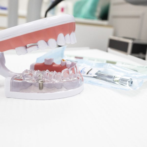 What are the types of dental fillings?
