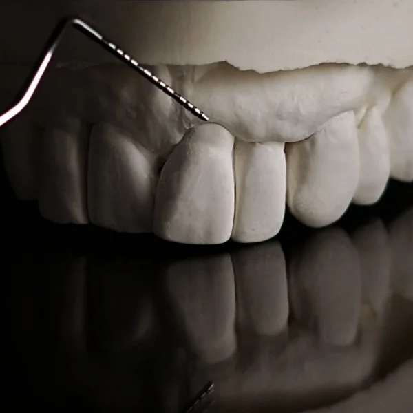 Odsłonięte szyjki zębowe — bolesny problem  © Warsaw Dental Center