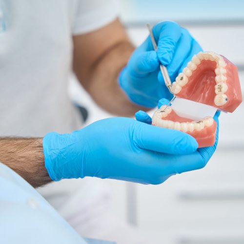 Dental technician showing to female client her problem teeth on 3d model, explaining way of treatment, advising professional flossing and brushing with fluoride toothpaste