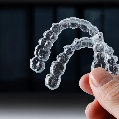 Invisalign overlays – Warsaw price