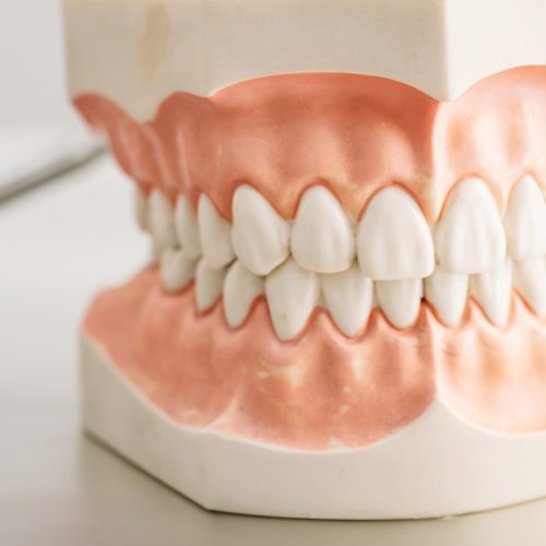 Mould of human teeth. Oral health concept. Mould of human teeth. Close up dental gypsum model. Plaster cast human jaws prothetic laboratory. Oral health concept