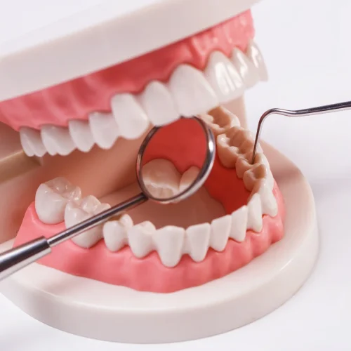 Leczenie kanałowe zęba: dlaczego tak ważna jest profilaktyka?